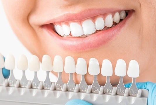 Closeup of smile compared with tooth color chart