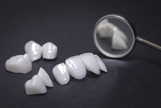Dental restorations prior to placement