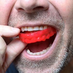 Man taking out red mouthguard