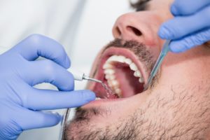 man at a dental cleaning 